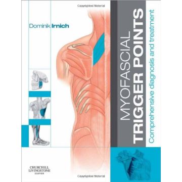 Myofascial Trigger Points - Comprehensive diagnosis and treatment    [Irnich  - Elsevier Science]