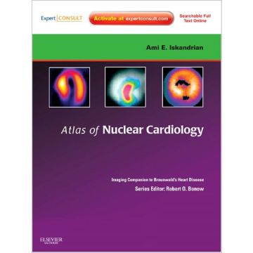 Atlas of Nuclear Cardiology: Imaging Companion to Braunwald's Heart Disease - EXPERT CONSULT - ONLINE AND PRINT  [Iskandrian - Elsevier Science]