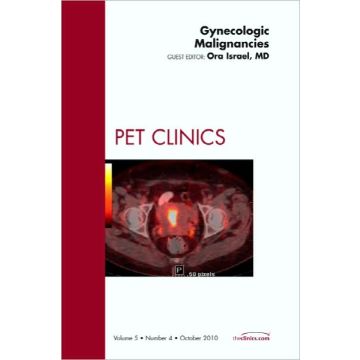 Gynecologic Malignancies, An Issue of PET Clinics