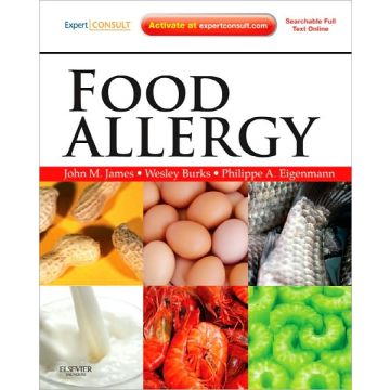 Food Allergy - EXPERT CONSULT BASIC         [James  - Elsevier Science]