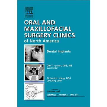 Dental Implants, An Issue of Oral and Maxillofacial Surgery Clinics   [Jensen - Elsevier Science]