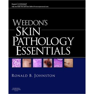 Weedon's Skin Pathology Essentials - EXPERT CONSULT: ONLINE AND PRINT