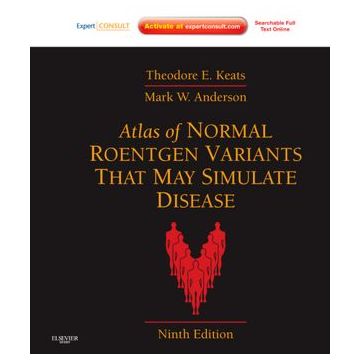 Atlas of Normal Roentgen Variants That May Simulate Disease, 9th Edition - EXPERT CONSULT - ENHANCED ONLINE FEATURES AND PRINT    [Keats  - Elsevier Science]