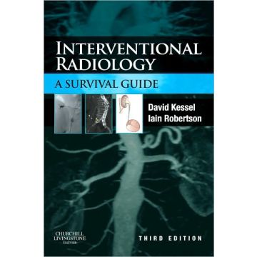 Interventional Radiology: A Survival Guide, 3rd Edition