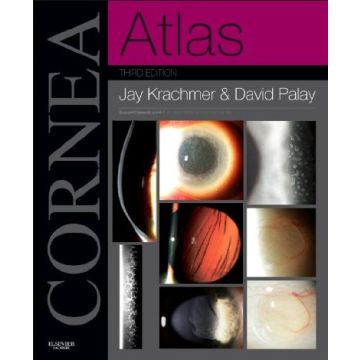 Cornea Atlas, 3rd Edition - Expert Consult - Online and Print    [Krachmer  - Elsevier Science]