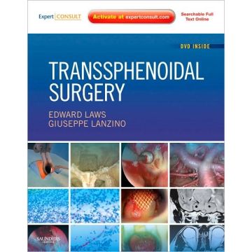 Transsphenoidal Surgery - Expert Consult - Online and Print 