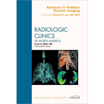 Advances in Pediatric Thoracic Imaging, An Issue of Radiologic Clinics of North America