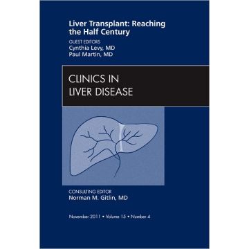 Liver Transplant: Reaching the half century, An Issue of Clinics in Liver Disease  [Martin - Elsevier Science]
