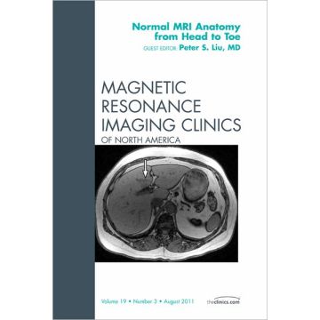 Normal MR Anatomy from Head to Toe, An Issue of Magnetic Resonance Imaging Clinics