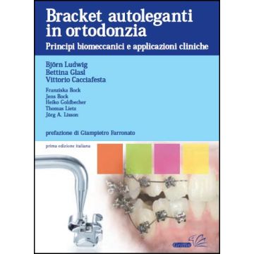 Bracket autoleganti in ortodonzia. Principi biomeccanici e applicazioni cliniche