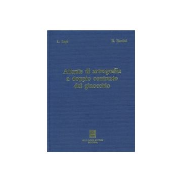 Atlante di artrografia a doppio contrasto del ginocchio