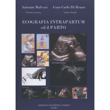 Ecografia Intrapartum ed il Parto    [Malvasi; Di Renzo - Laterza Giuseppe Edizioni]