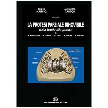 La Protesi Parziale Rimovibile dalla teoria alla pratica