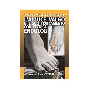 L'alluce valgo e il suo trattamento con tecnica endolog