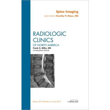 Spine Imaging, An Issue of Radiologic Clinics of North America   [Maus  - Elsevier Science]