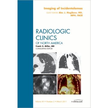 Imaging of Incidentalomas, An Issue of Radiologic Clinics of North America