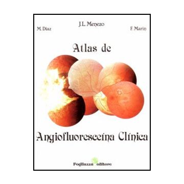 Atlas de Angiofluoresceina Clinica  Voll.1/2