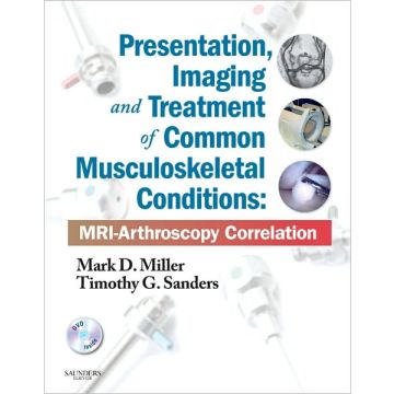Presentation, Imaging and Treatment of Common Musculoskeletal Conditions - MRI-Arthroscopy Correlation (Expert Consult - Online and Print)