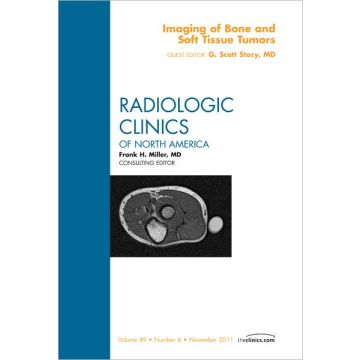 Imaging of Bone and Soft Tissue Tumors, An Issue of Radiologic Clinics of North America
