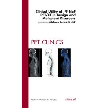 Clinical Utility of 18NaF PET/CT in Benign and Malignant Disorders, An Issue of PET Clinics   [Beheshti  - Elsevier Science]