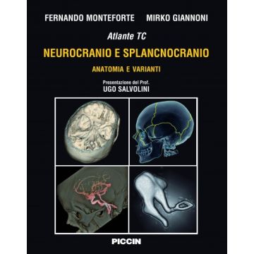 Atlante TC Neurocranio e Splancnocranio - Anatomia e varianti     [Monteforte  - Piccin Editore]