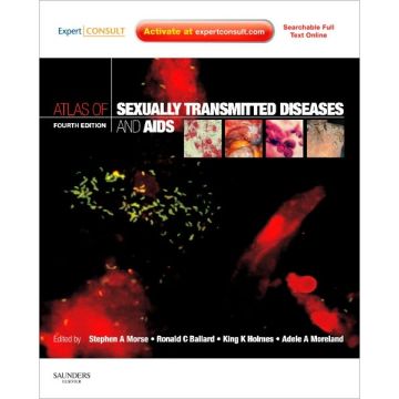 Atlas of Sexually Transmitted Diseases and AIDS, 4th Edition - Expert Consult