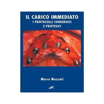 Il carico immediato in implantologia. Protocolli operativi  + DVD  [Mozzati - RCLibri]