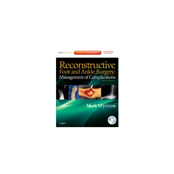 Reconstructive Foot and Ankle Surgery: Management of Complications , 2nd Edition - Expert Consult - Online, Print, and DVD