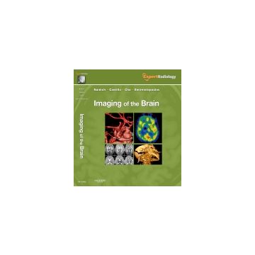 Imaging of the Brain - EXPERT RADIOLOGY SERIES  [Naidich  - Elsevier Science]