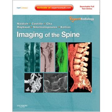 Imaging of the Spine - Expert Radiology Series, Expert Consult-Online and Print