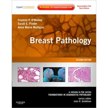 Breast Pathology, 2nd Edition - A Volume in the Foundations in Diagnostic Pathology series (Expert Consult - Online and Print)