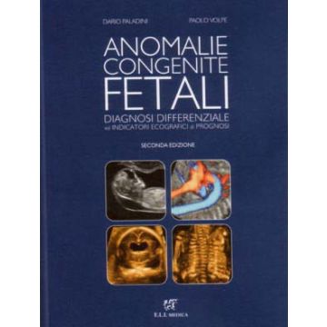 Anomalie Congenite Fetali. Diagnosi Differenziale ed Indicatori Ecografici di Prognosi 2/ed. [Paladini; Volpe - Eli Medica]