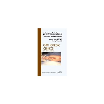 Autologous Techniques to Fill Bone Defects for Acute Fractures and Nonunions, An Issue of Orthopedic Clinics Volume 41-1