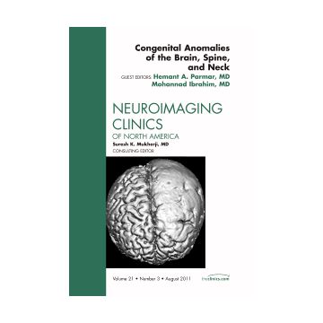 Congenital Anomalies of the Brain, Spine, and Neck, An Issue of Neuroimaging Clinics