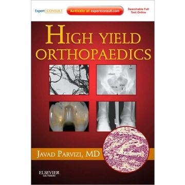 High Yield Orthopaedics - Expert Consult - Online and Print