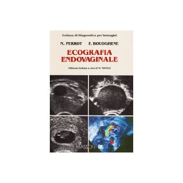 Ecografia endovaginale