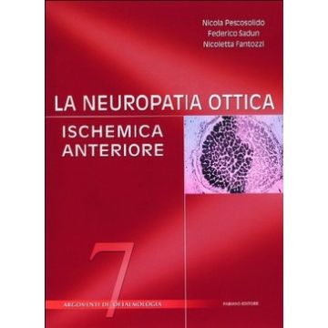 La neuropatia ottica ischemica anteriore  [Pescosolido  - FABIANO]