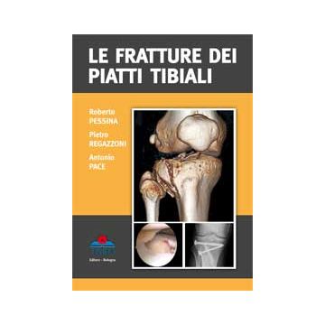 Le fratture dei Piatti Tibiali [Pessina - Timeo Editore]