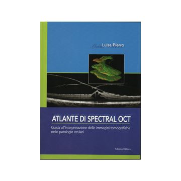 Atlante di SPECTRAL OCT - Guida all' interpretazione delle immagini tomografiche nelle patologie oculari