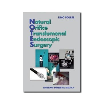 Natural Orifice Translumenal Endoscopic Surgery    [Polese - Minerva Medica]