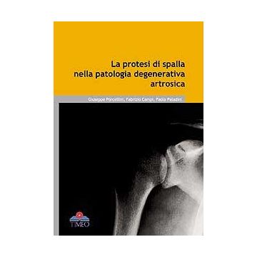La Protesi di Spalla nella Patologia degenerativa artrosica