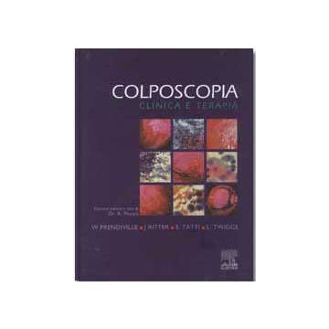 COLPOSCOPIA - Clinica e terapia
