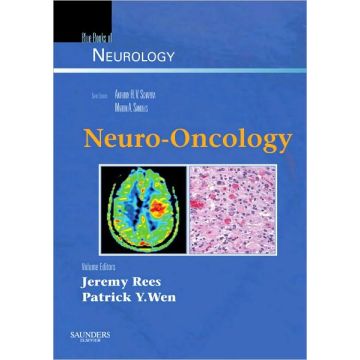 Neuro-Oncology - BLUE BOOKS OF NEUROLOGY SERIES
