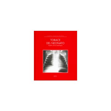 TORACE DEL NEONATO. Aspetti clinico Radiologici