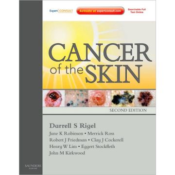 Cancer of the Skin, 2nd Edition - Expert Consult - Online and Print