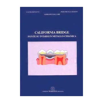 California Bridge - Ponte su intarsi in metallo - ceramica [Rovatti; Dallari - Martina Edizioni]