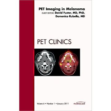 Pet Imaging in Melanoma, An Issue of PET Clinics
