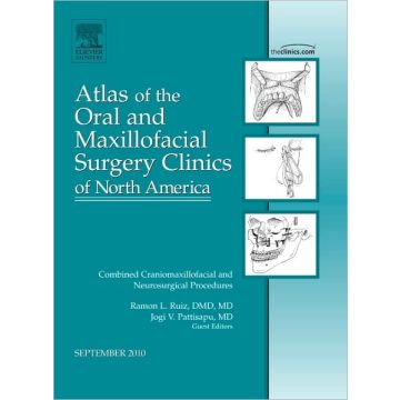 Combined Craniomaxillofacial and Neurosurgical Procedures, An Issue of Atlas of the Oral and Maxillofacial Surgery Clinics 