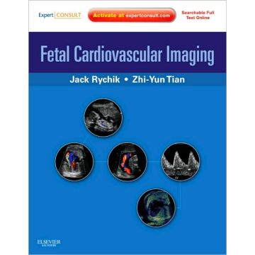 Fetal Cardiovascular Imaging: A Disease Based Approach - EXPERT CONSULT PREMIUM EDITION: ENHANCED ONLINE FEATURES AND PRINT  [Rychik  - Elsevier Science]