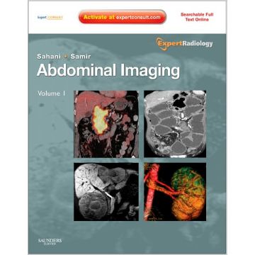 Abdominal Imaging, 2-Volume Set - EXPERT RADIOLOGY SERIES EXPERT CONSULT- ONLINE AND PRINT